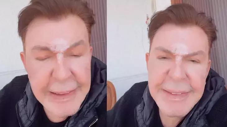 Yüzünü gerdiren Kuşum Aydın isyan etti: Benden bu kadar!