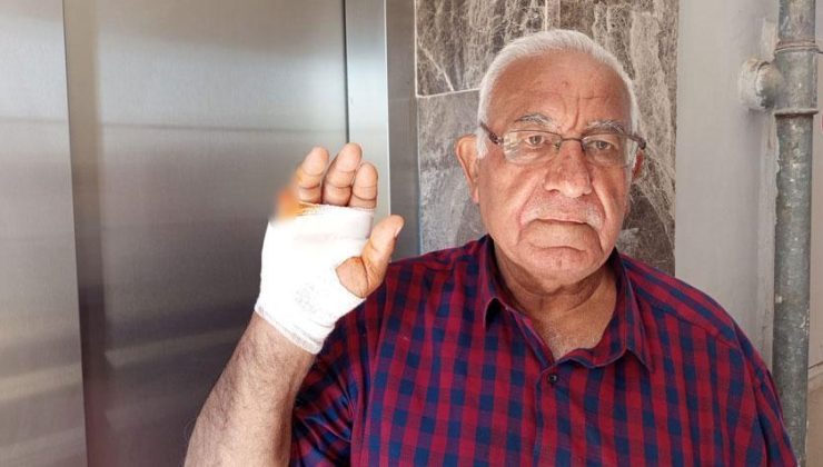Asansörde korkunç saldırı! Komşusu parmağını ısırarak kopardı: Onu çok severdim, niçin yaptı anlamadım