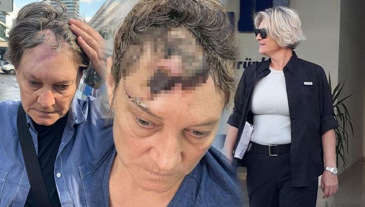 Emekli polis, iş insanının yakın koruması olarak çalışıyordu hayatı 10 dakikada kabusa döndü: ‘Ruhen öldüm, sadece nefes alıyorum’