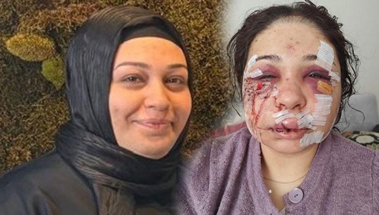 Yüzüne 60 dikiş atılmıştı! Eşini darbeden polis memuru tahliye edildi