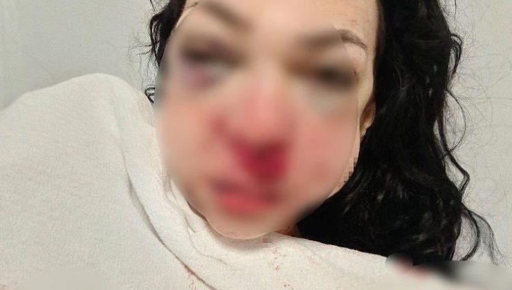 İzmit’te kafe kavgası! Kadının yüzüne kül tablası ve bardak fırlattı