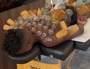 Onana bu kez sahada değil, hacamat sırasında görüntülendi