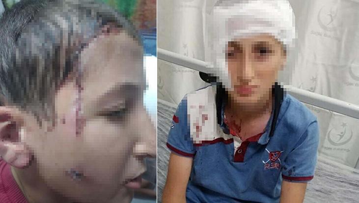 Yüzünde 12 santimlik iz bıraktı! Milyonluk tazminat kararı
