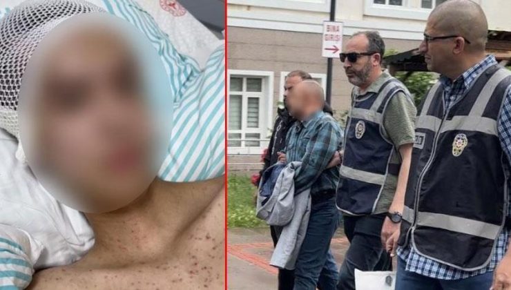 Çocuğu taciz etti, direnince kafasından vurdu! Korkunç olay 1 ay sonra ortaya çıktı: Sağ elinde silah bulunan mağdur solak çıktı