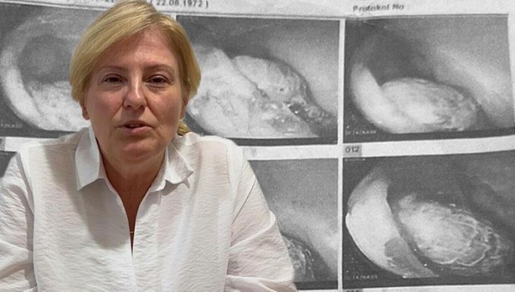 Haberler: Ameliyatta vücudunda unutulmuş! Her şeyi 4 yıl sonra öğrendi!