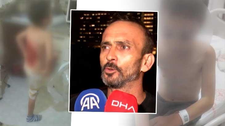 İstanbul’da dehşet! 12 yaşındaki Batuhan’ı arkadaşları kolonya döküp ateşe verdi