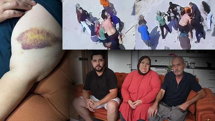 Zincir, keser, sopa ve bıçak… İki ailenin meydan savaşı: Mangal yapıp bize gıcıklık veriyorlar